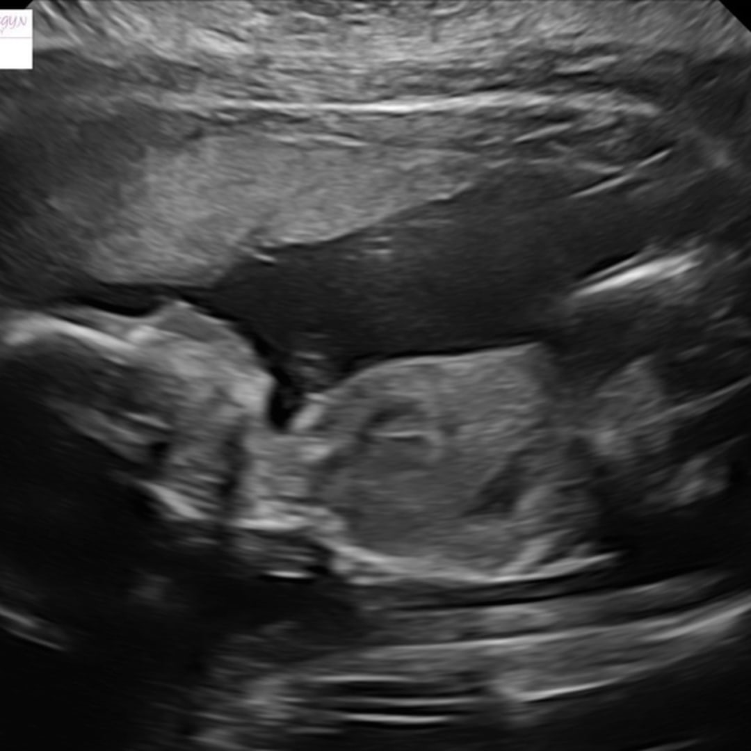 Photo shared by Heaven for their Babylist baby registry.