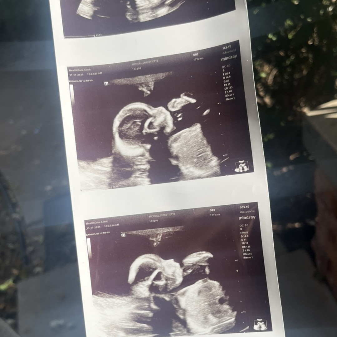 Photo shared by Christiette for their Babylist baby registry.