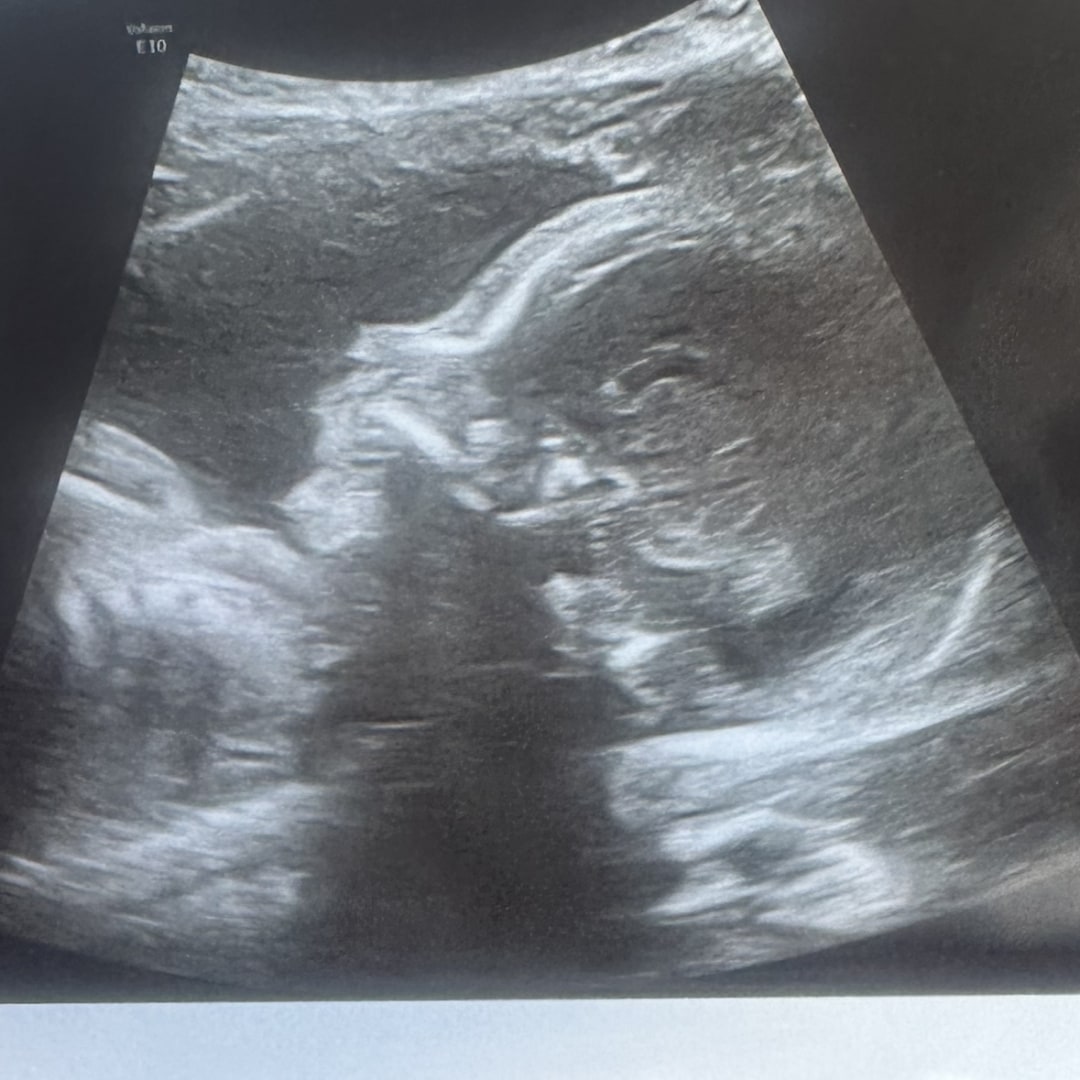 Photo shared by Sydney for their Babylist baby registry.