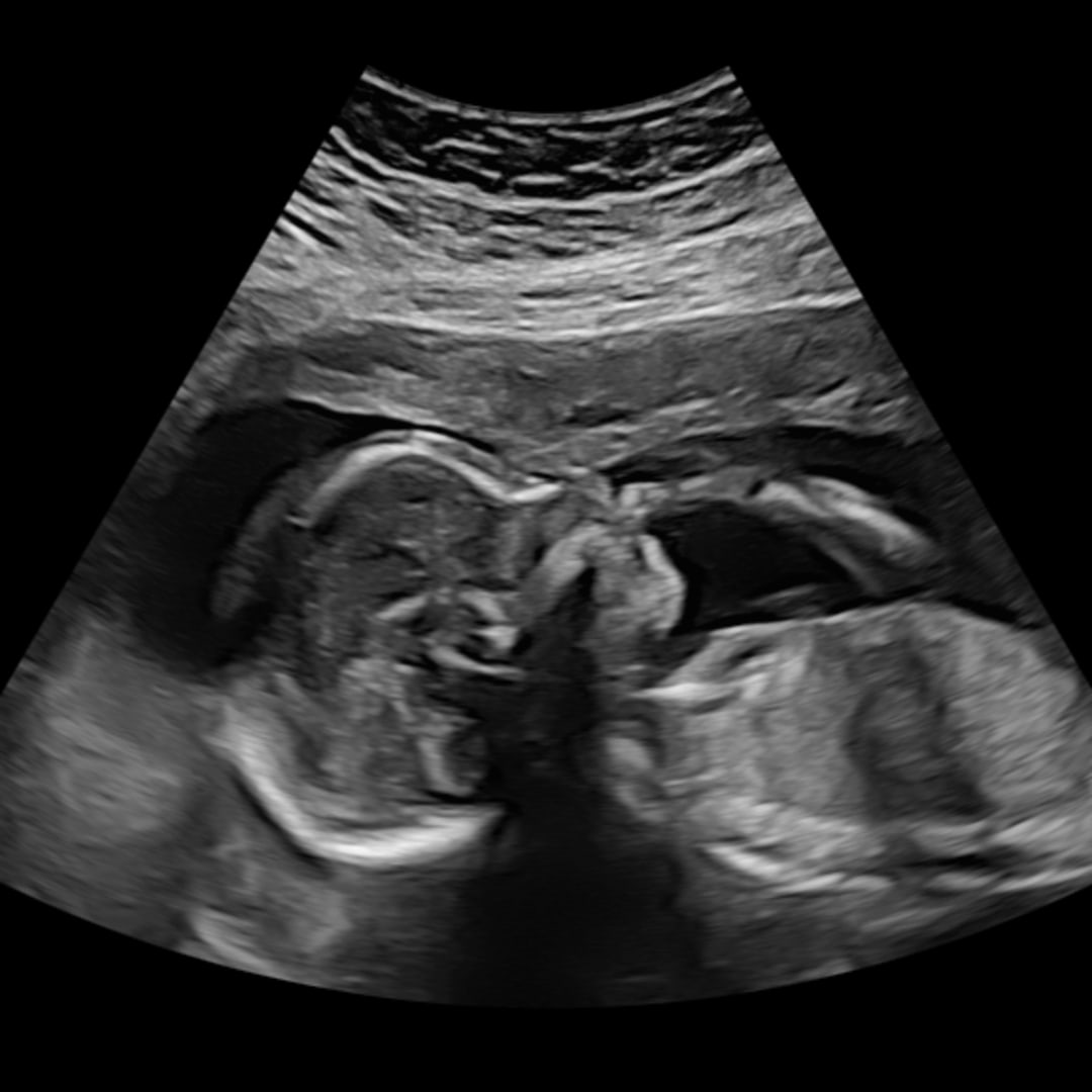Photo shared by Amei for their Babylist baby registry.