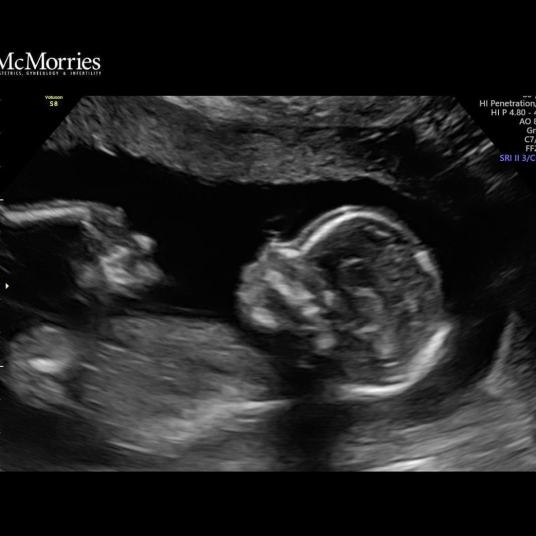 Photo shared by Cheyenne for their Babylist baby registry.