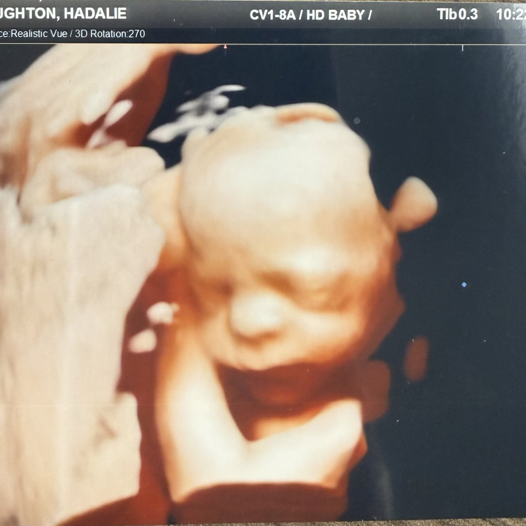 Photo shared by Hadalie for their Babylist baby registry.