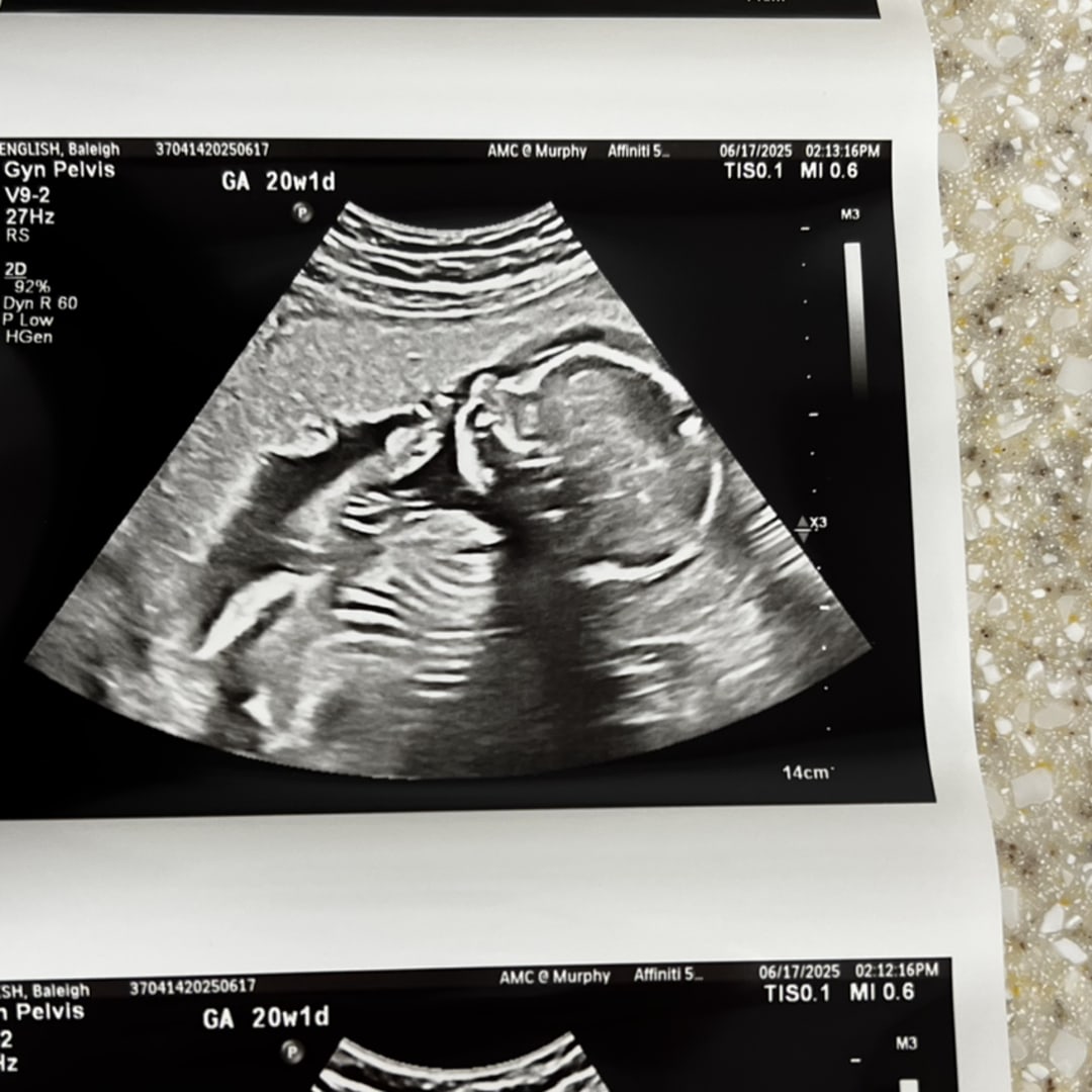 Photo shared by Bayleigh for their Babylist baby registry.