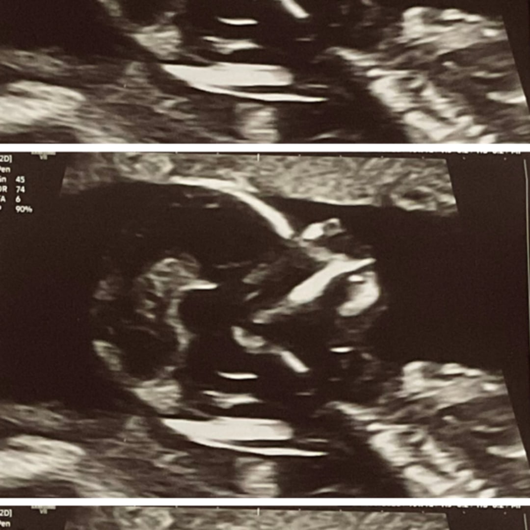 Photo shared by Angelina for their Babylist baby registry.