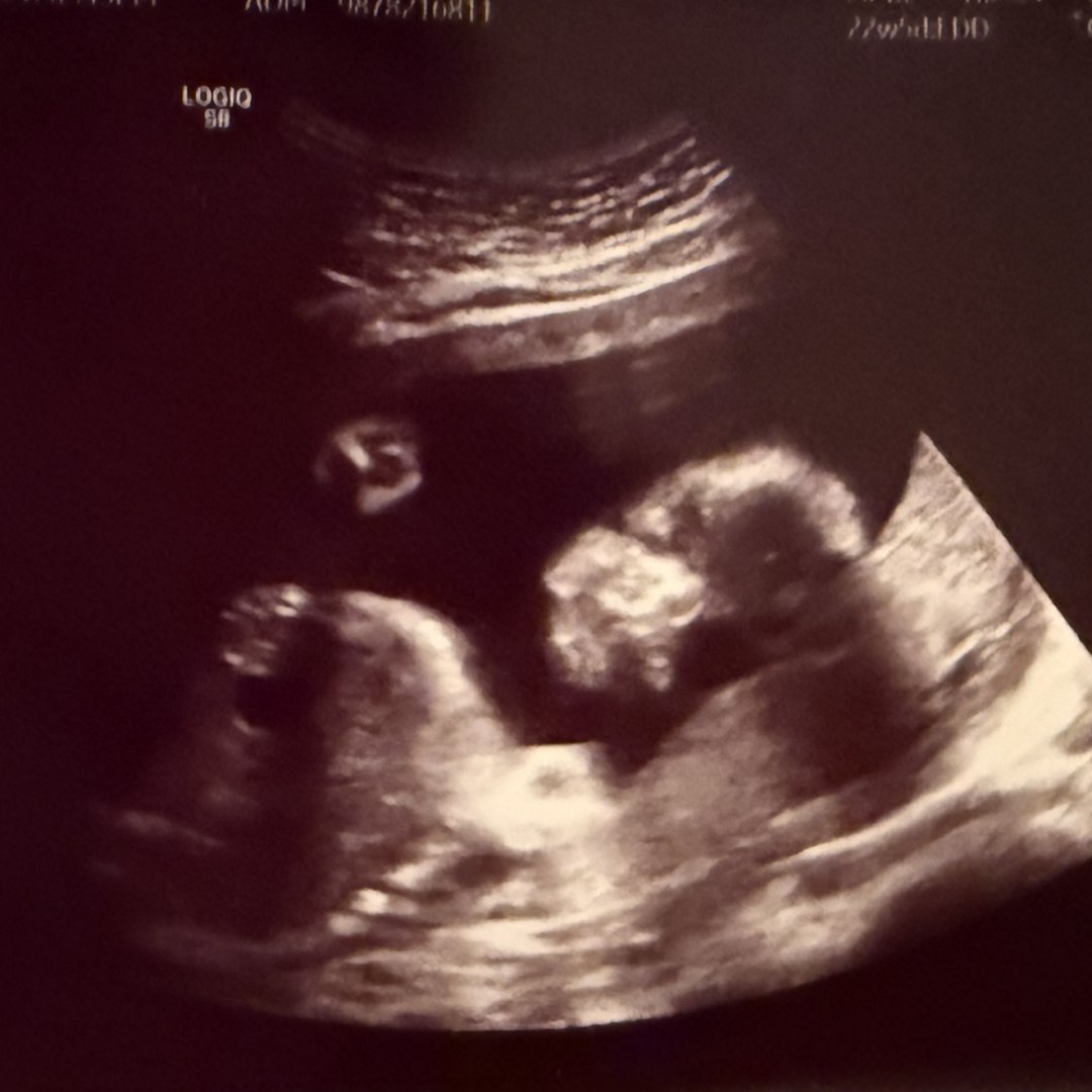 Photo shared by Alayah for their Babylist baby registry.