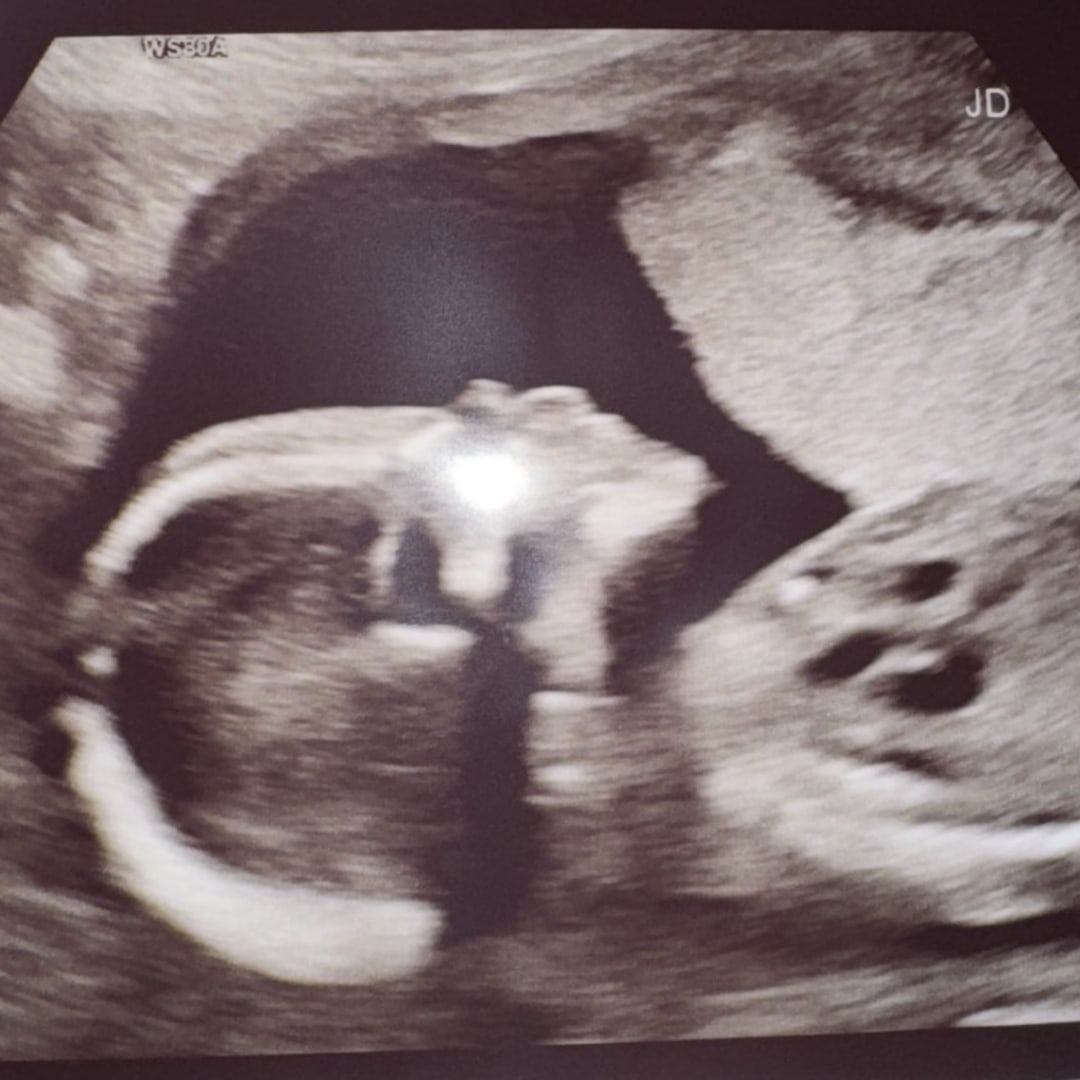 Photo shared by Lily for their Babylist baby registry.