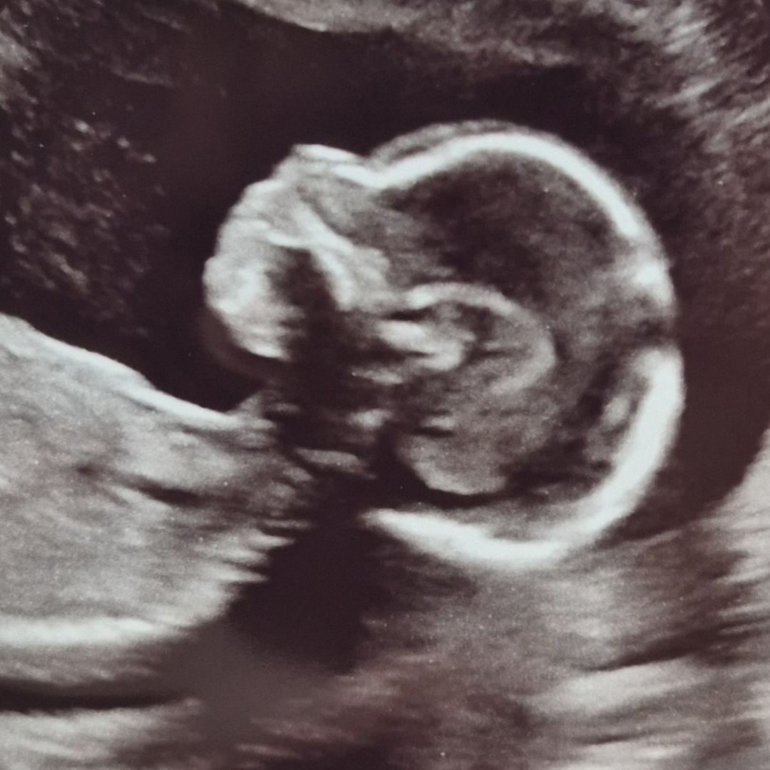 Photo shared by Ciara for their Babylist baby registry.