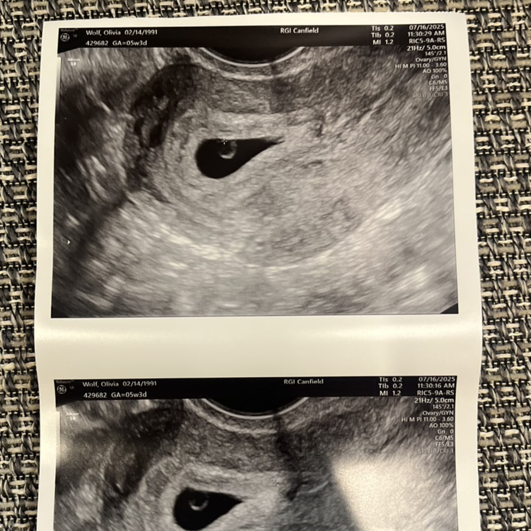 Photo shared by Olivia for their Babylist baby registry.