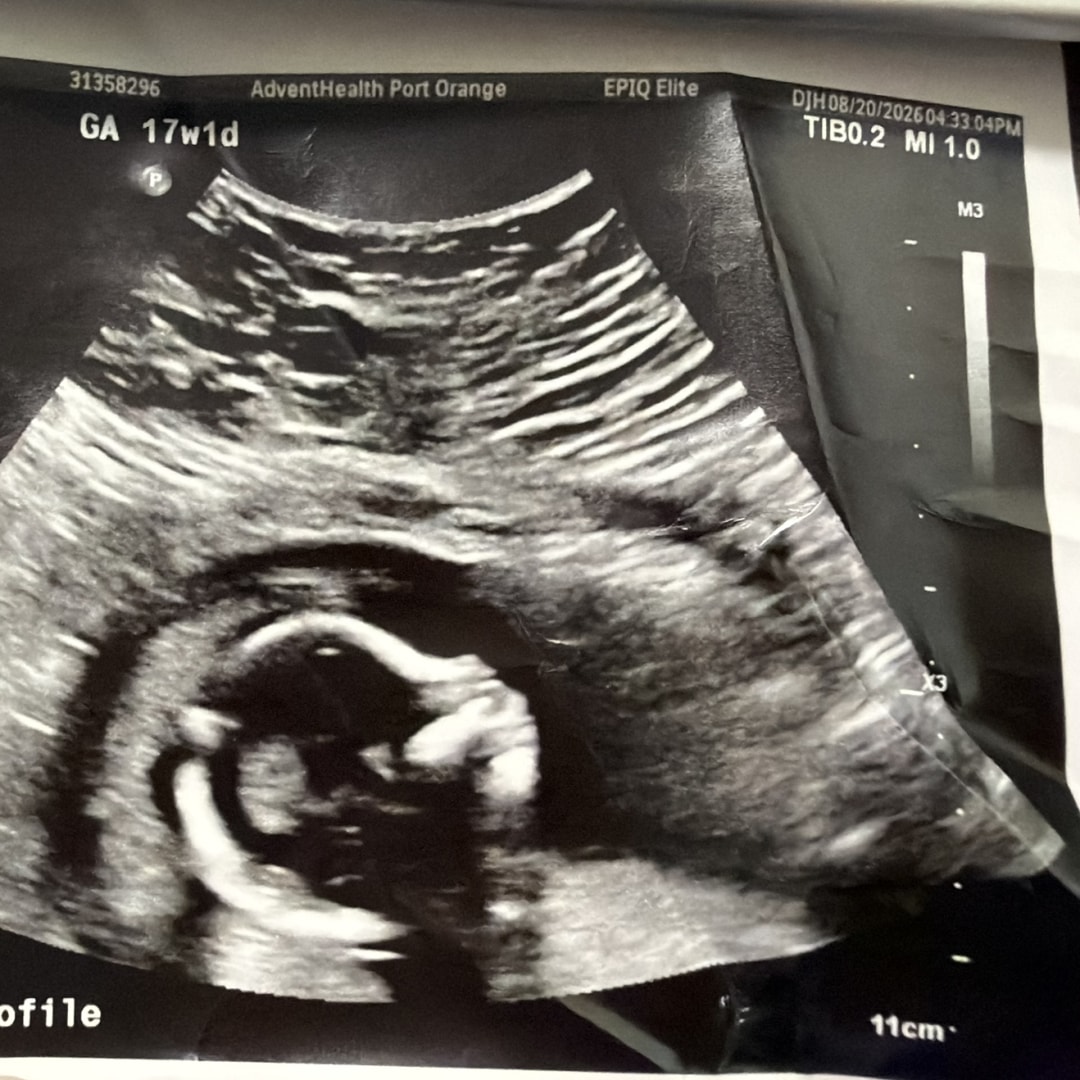 Photo shared by Amber for their Babylist baby registry.