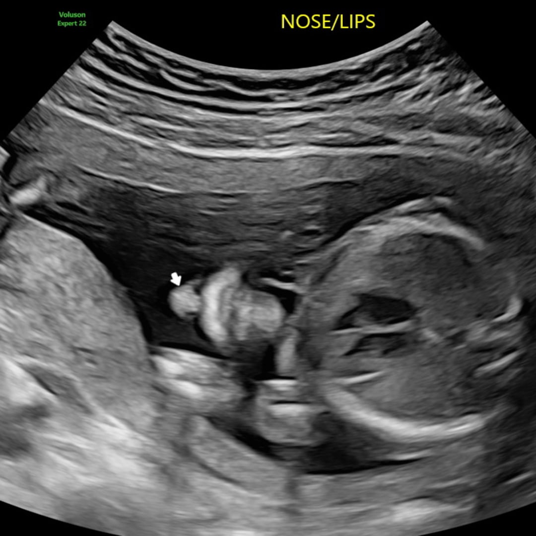 Photo shared by Abigail for their Babylist baby registry.