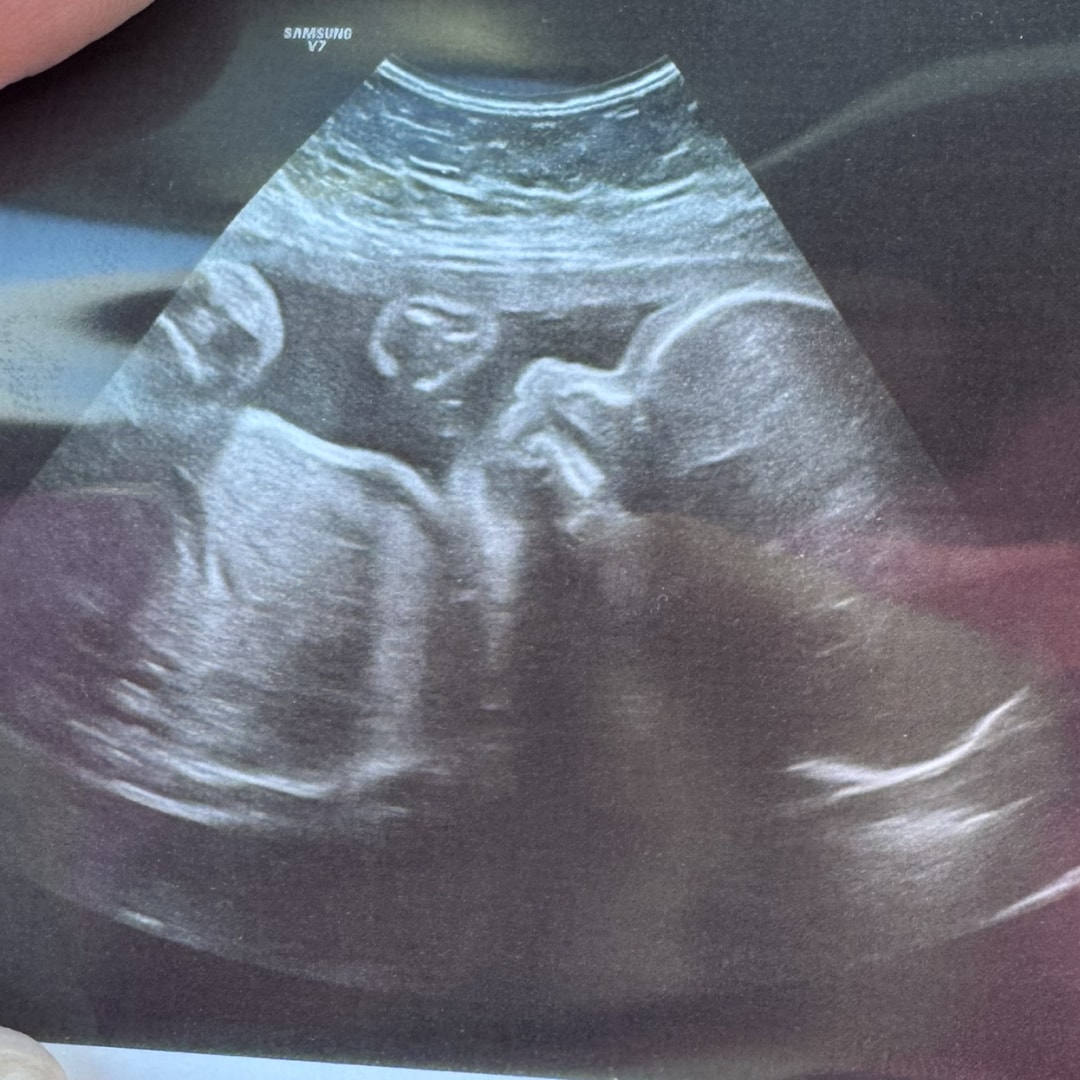 Photo shared by Emily for their Babylist baby registry.