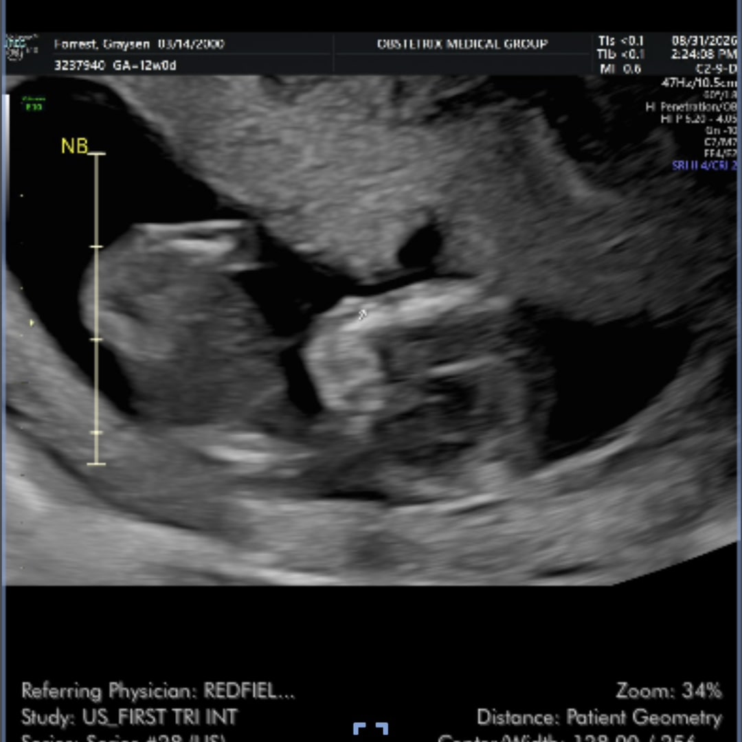 Photo shared by Graysen for their Babylist baby registry.