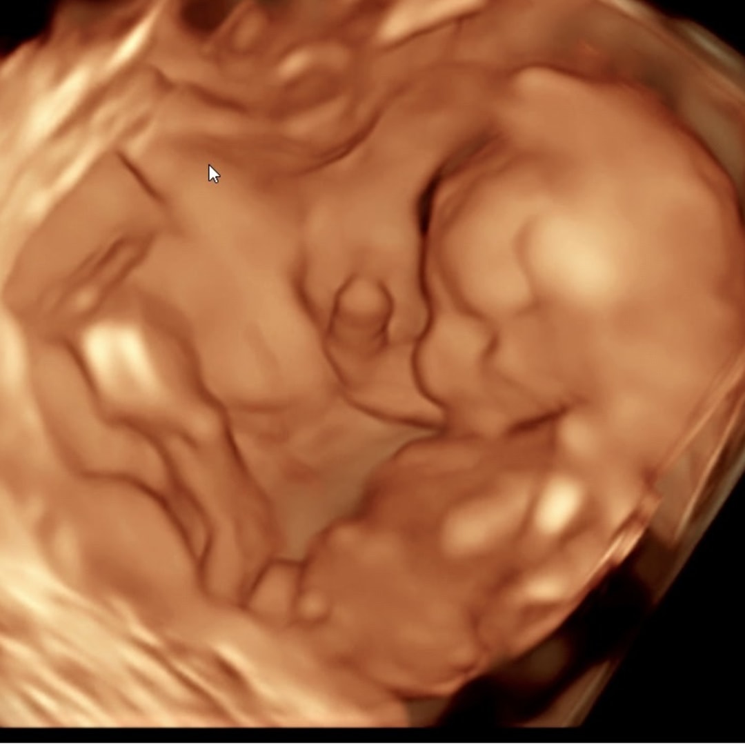 Photo shared by Paige for their Babylist baby registry.
