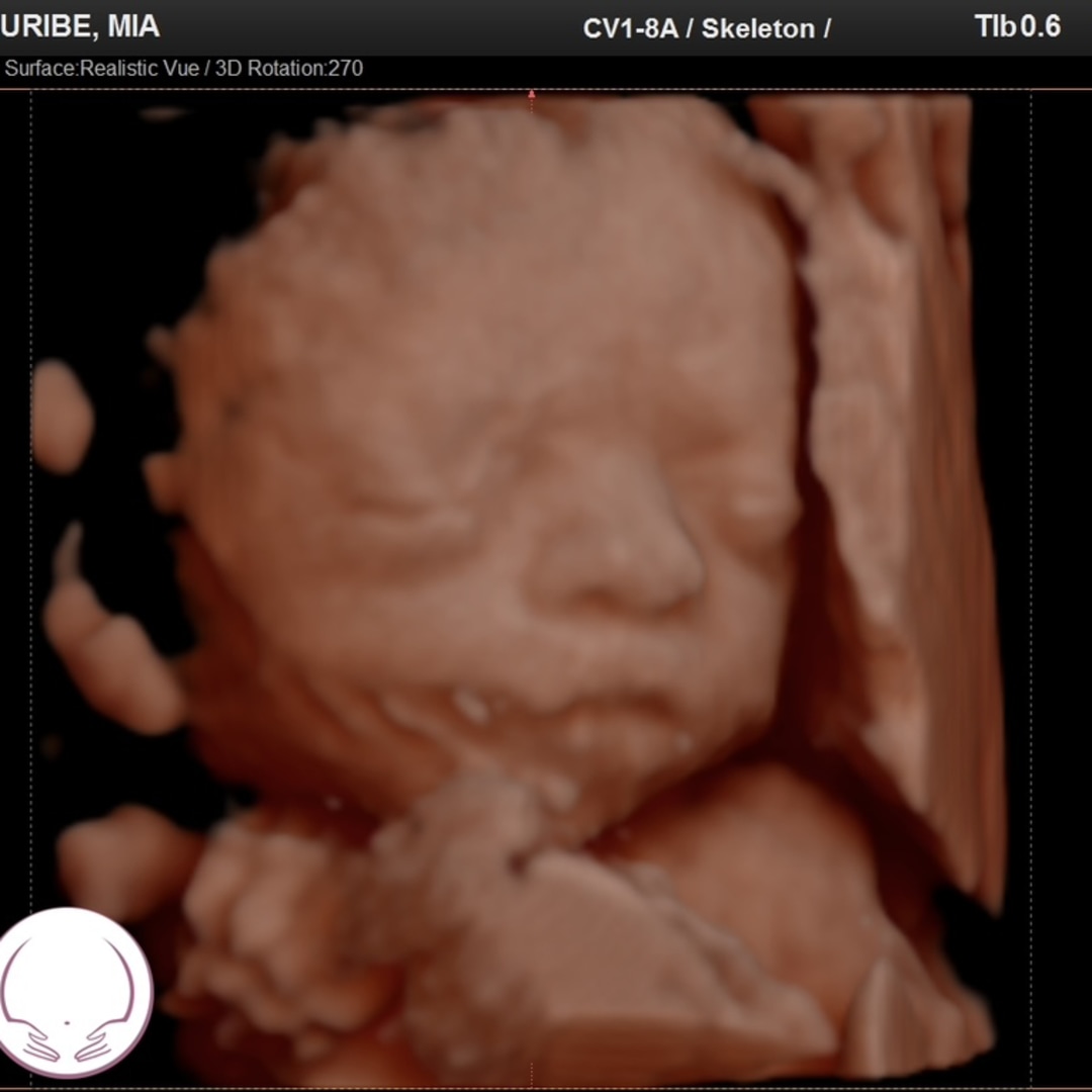 Photo shared by Mia for their Babylist baby registry.