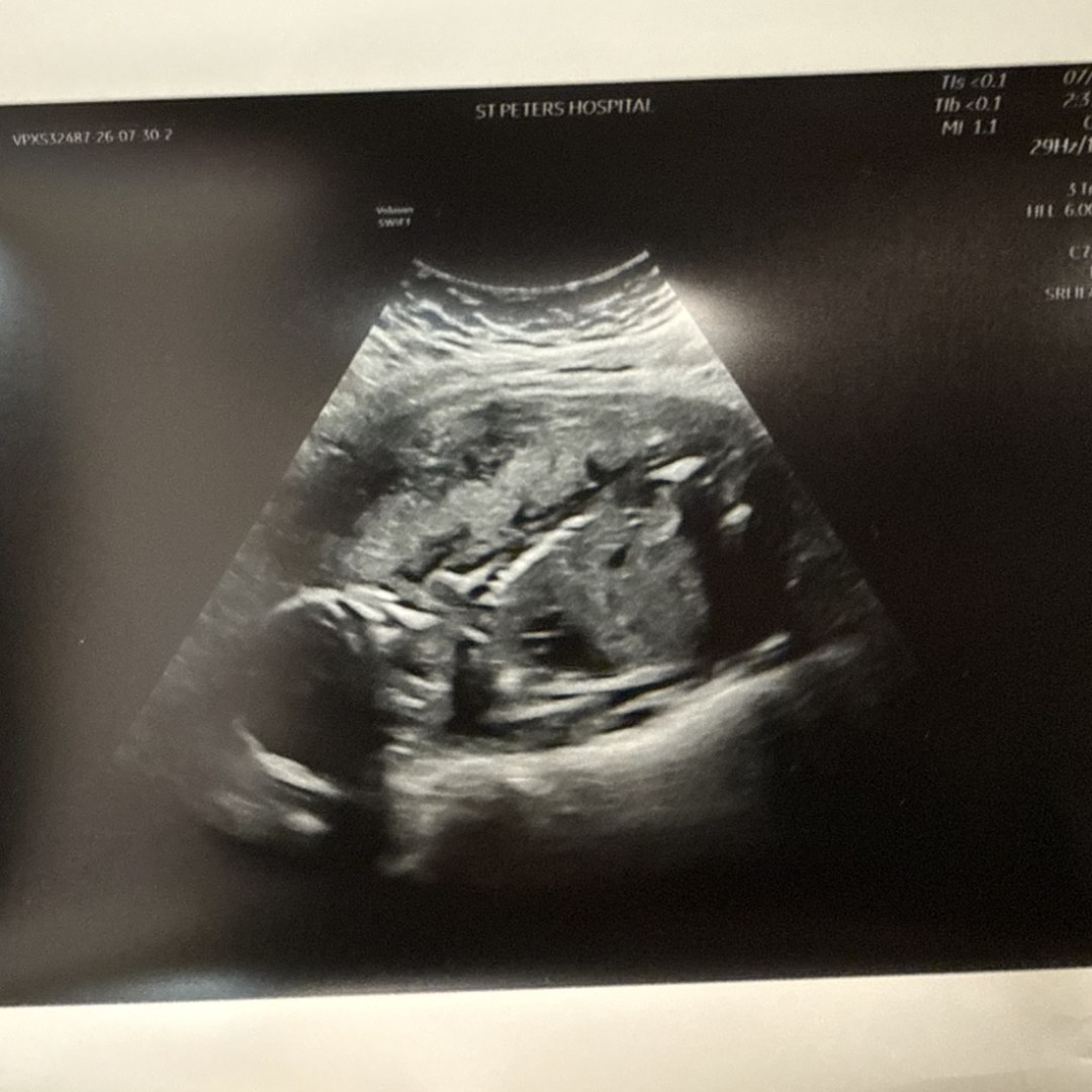 Photo shared by Jenna for their Babylist baby registry.