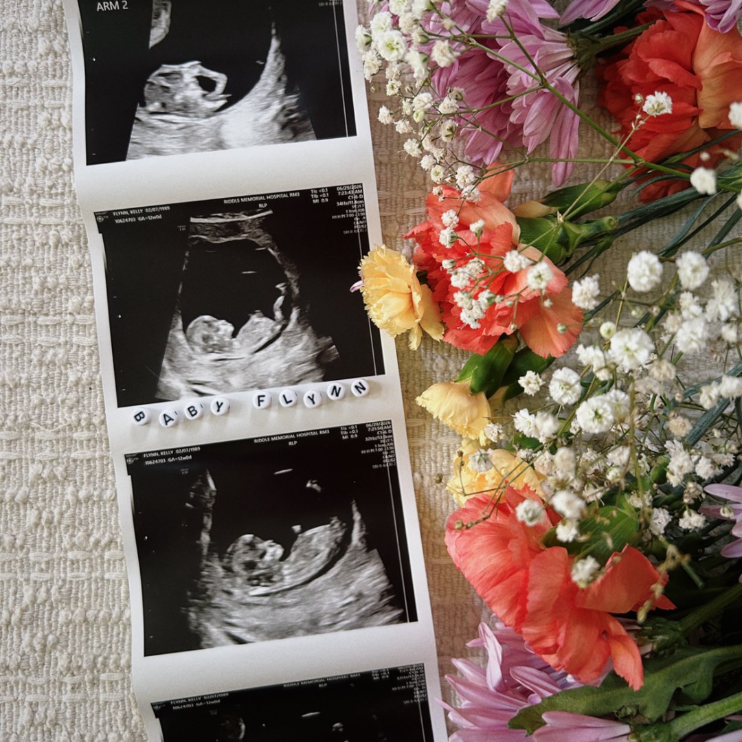 Photo shared by Kelly for their Babylist baby registry.
