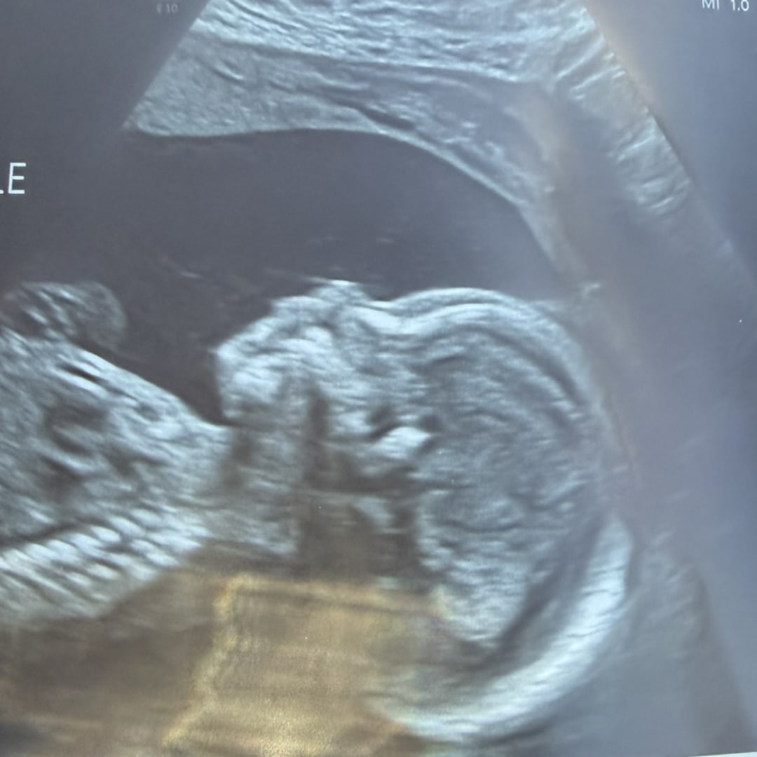 Photo shared by Emily for their Babylist baby registry.