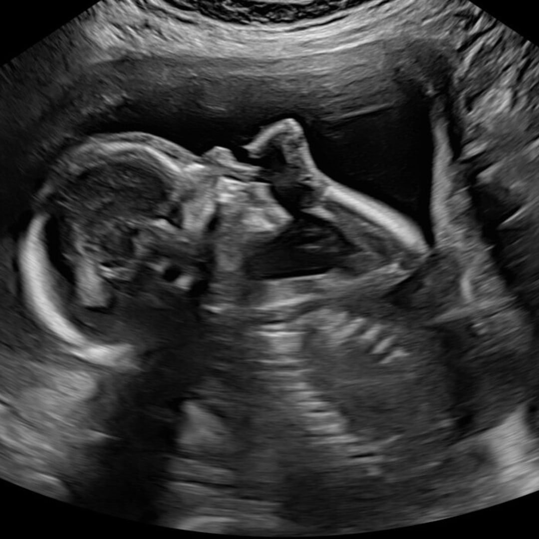 Photo shared by Liliana for their Babylist baby registry.