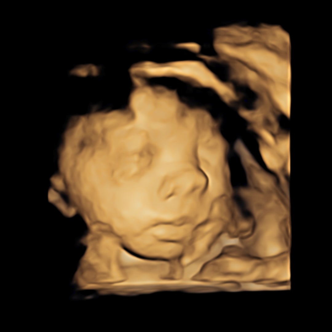 Photo shared by Freilin for their Babylist baby registry.