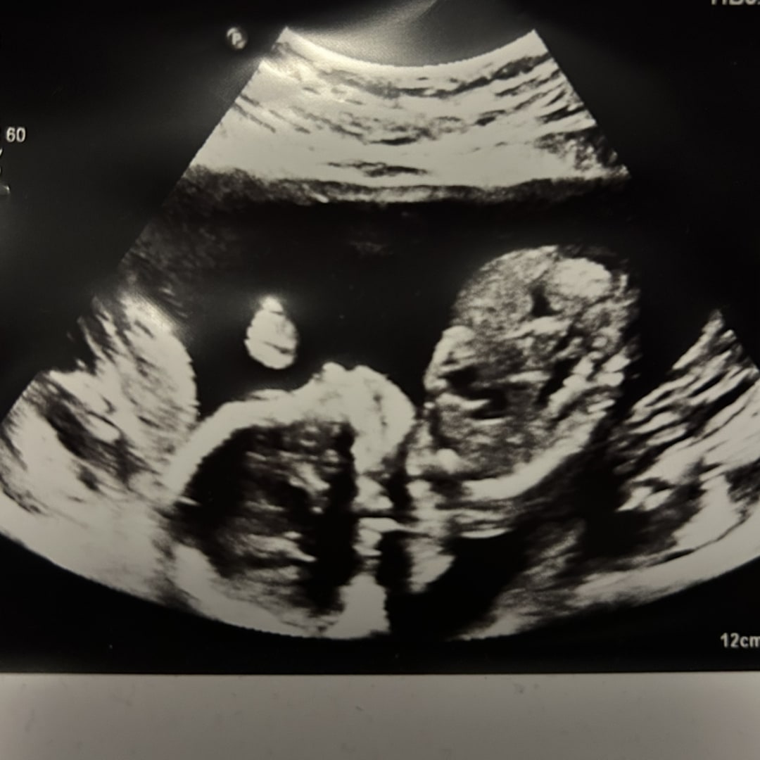 Photo shared by Carla for their Babylist baby registry.