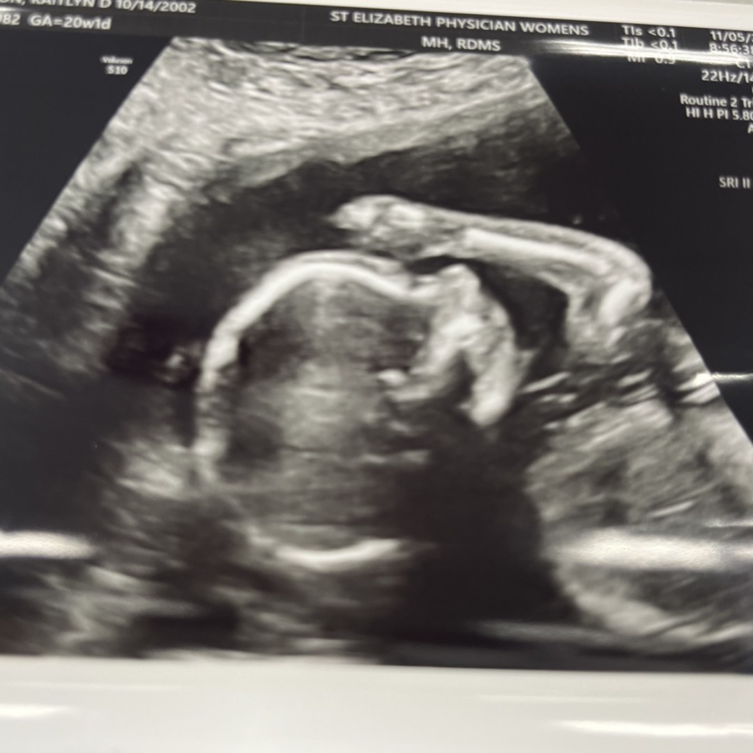 Photo shared by Kaitlyn for their Babylist baby registry.