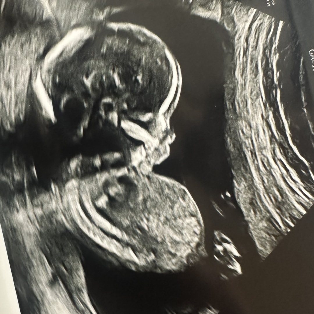 Photo shared by Shawnda for their Babylist baby registry.