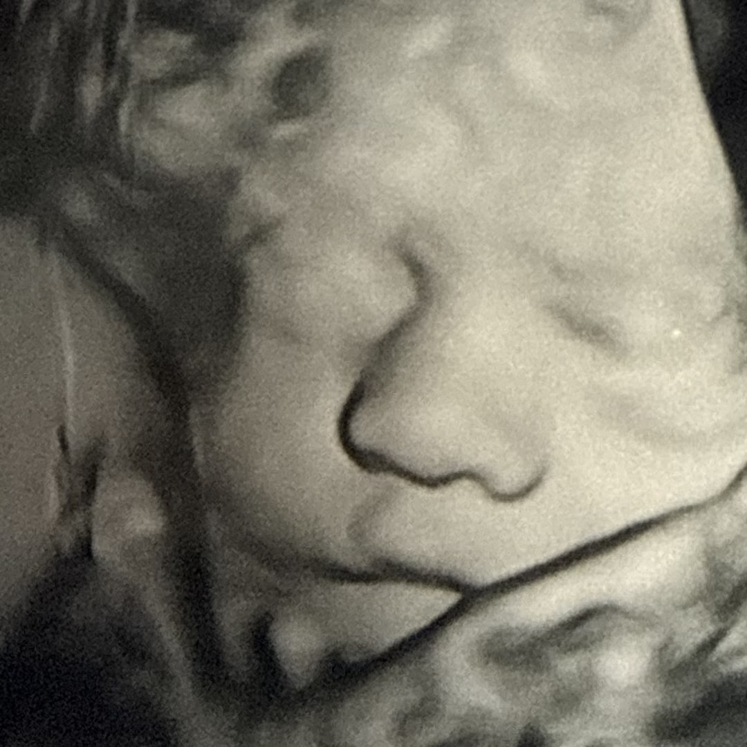 Photo shared by Carlie for their Babylist baby registry.