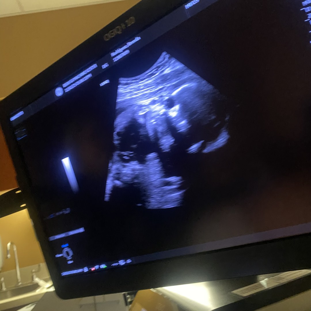 Photo shared by Brenda for their Babylist baby registry.