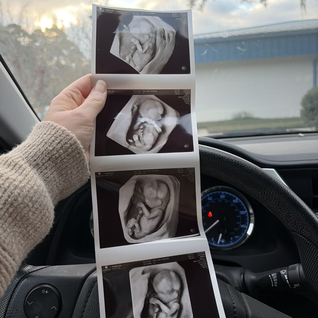 Photo shared by Lila for their Babylist baby registry.