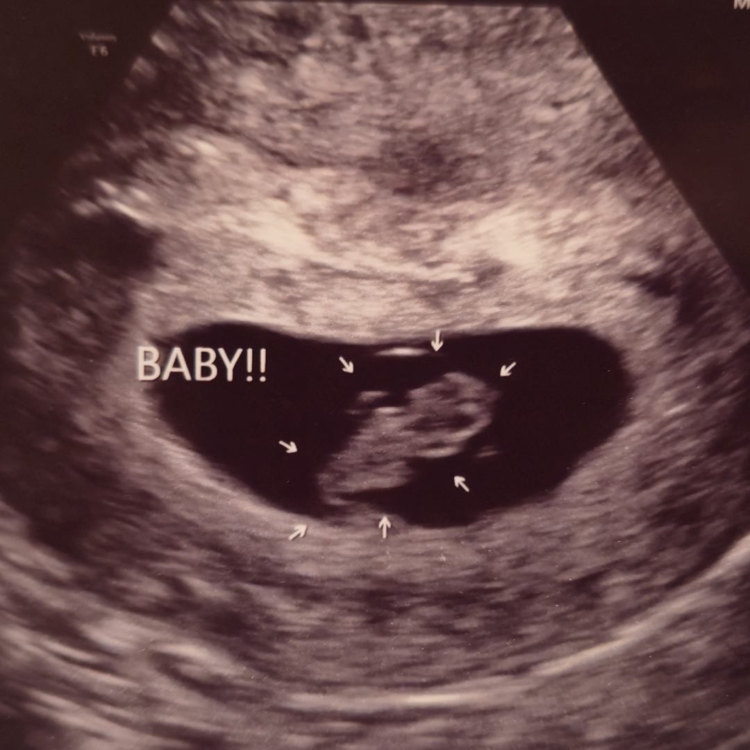 Photo shared by Cameron for their Babylist baby registry.