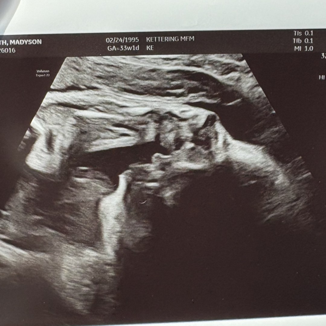 Photo shared by Madyson for their Babylist baby registry.
