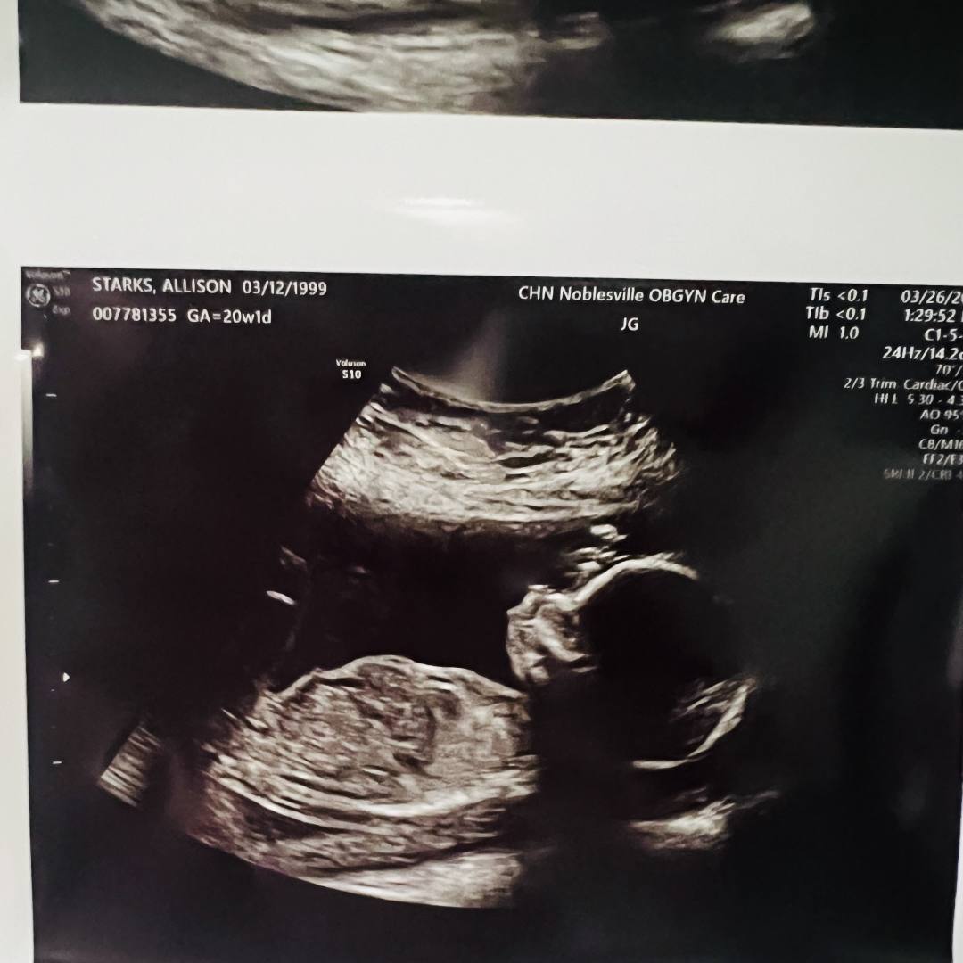 Photo shared by Allison for their Babylist baby registry.