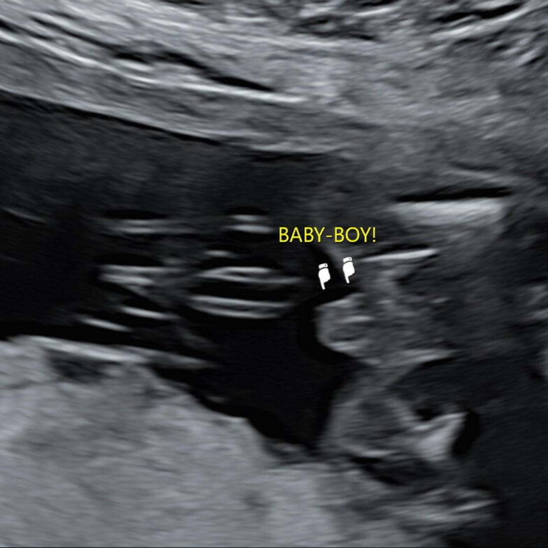 Photo shared by Chantal for their Babylist baby registry.