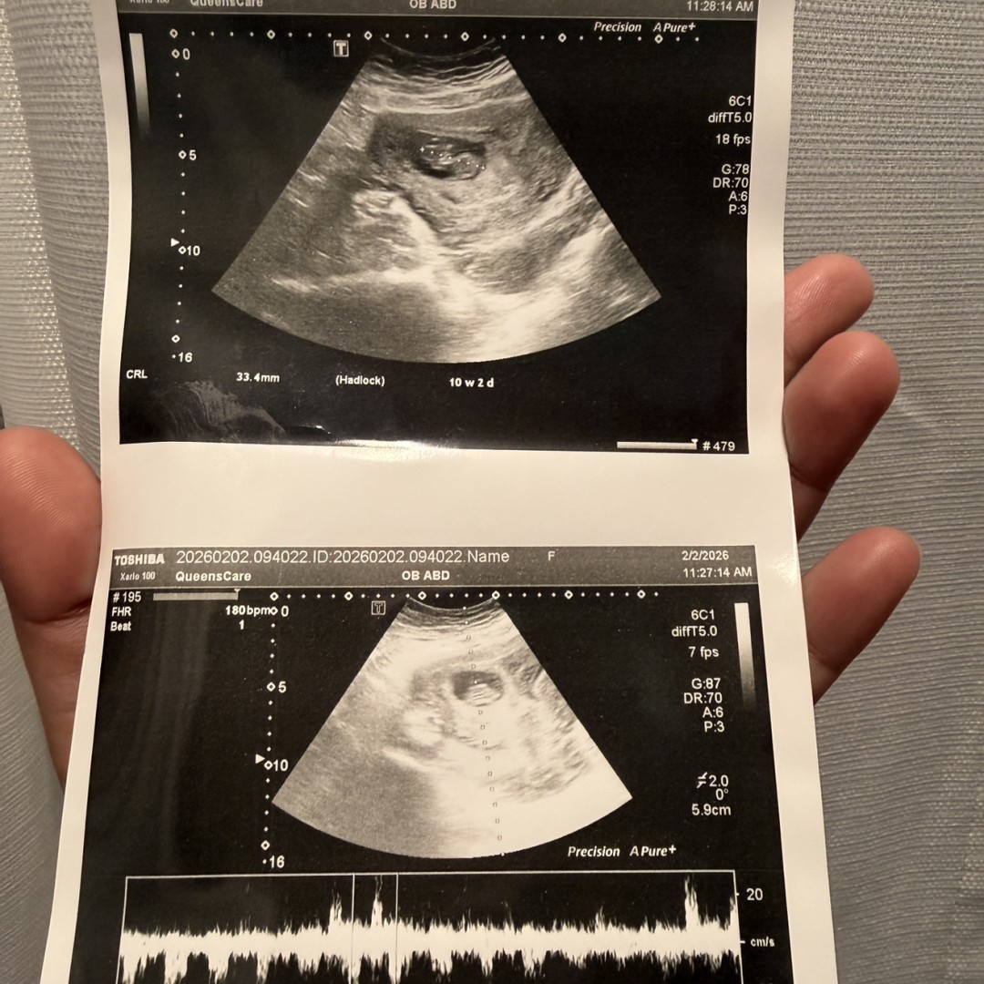 Photo shared by Jovilyn for their Babylist baby registry.