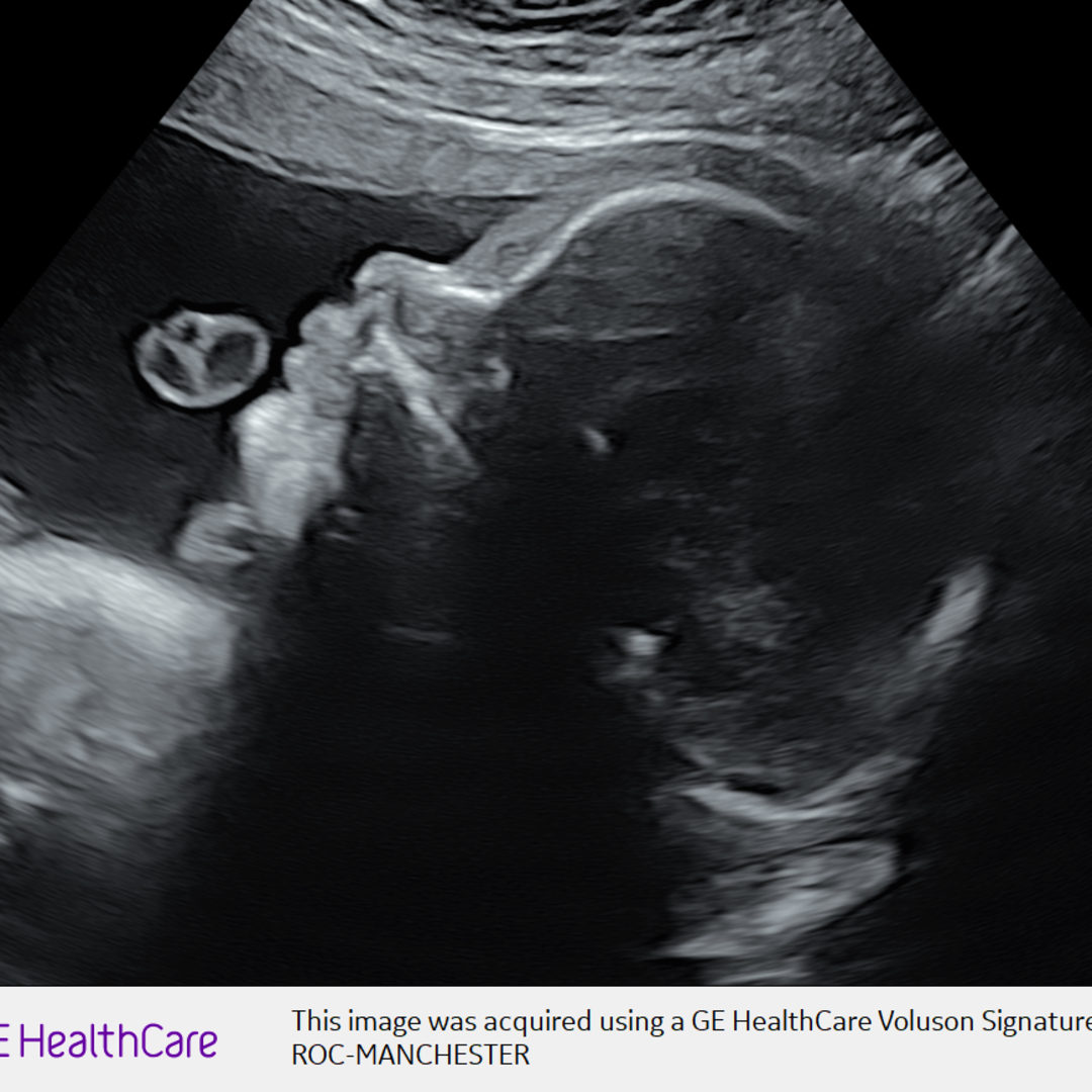 Photo shared by Jessa for their Babylist baby registry.