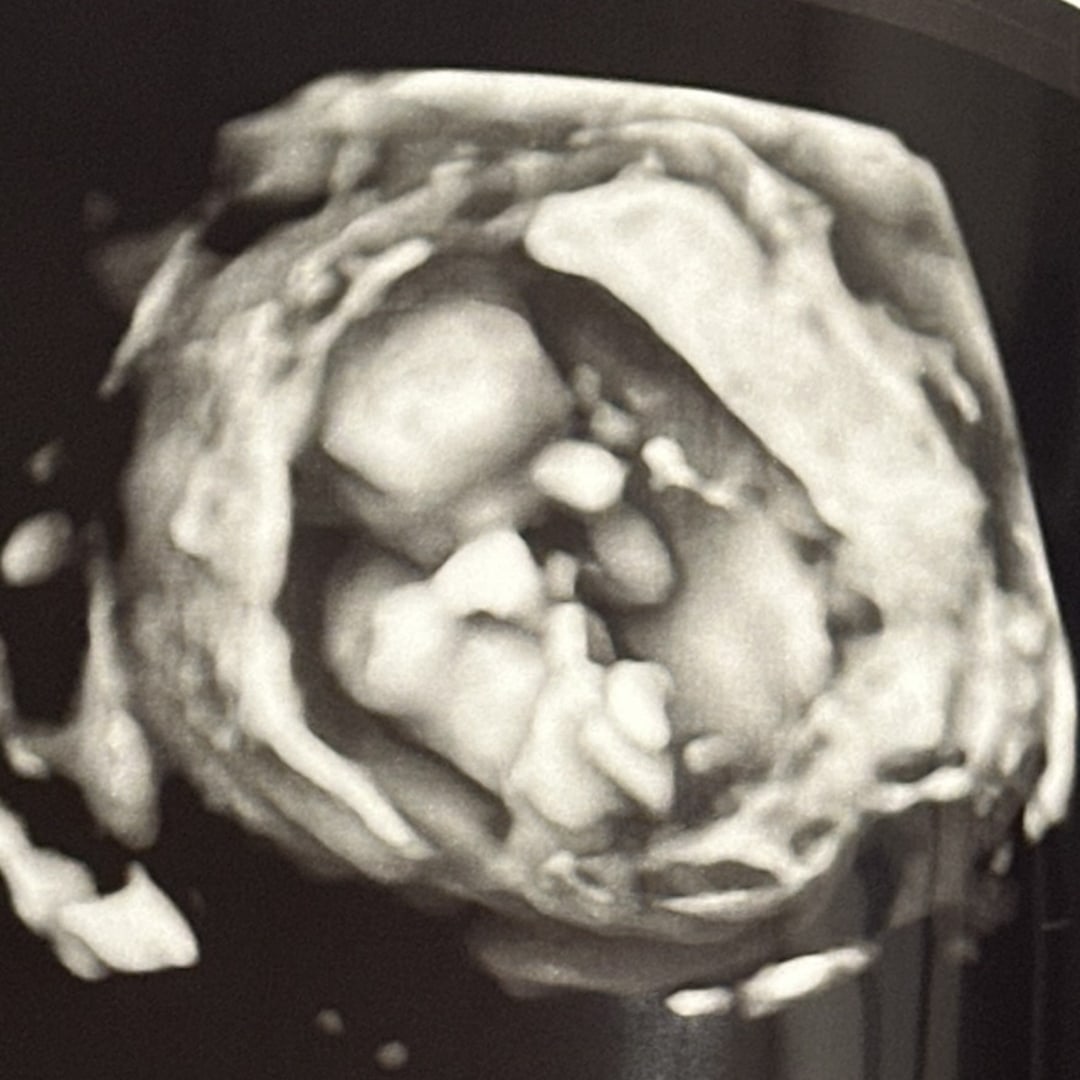 Photo shared by Angelina for their Babylist baby registry.