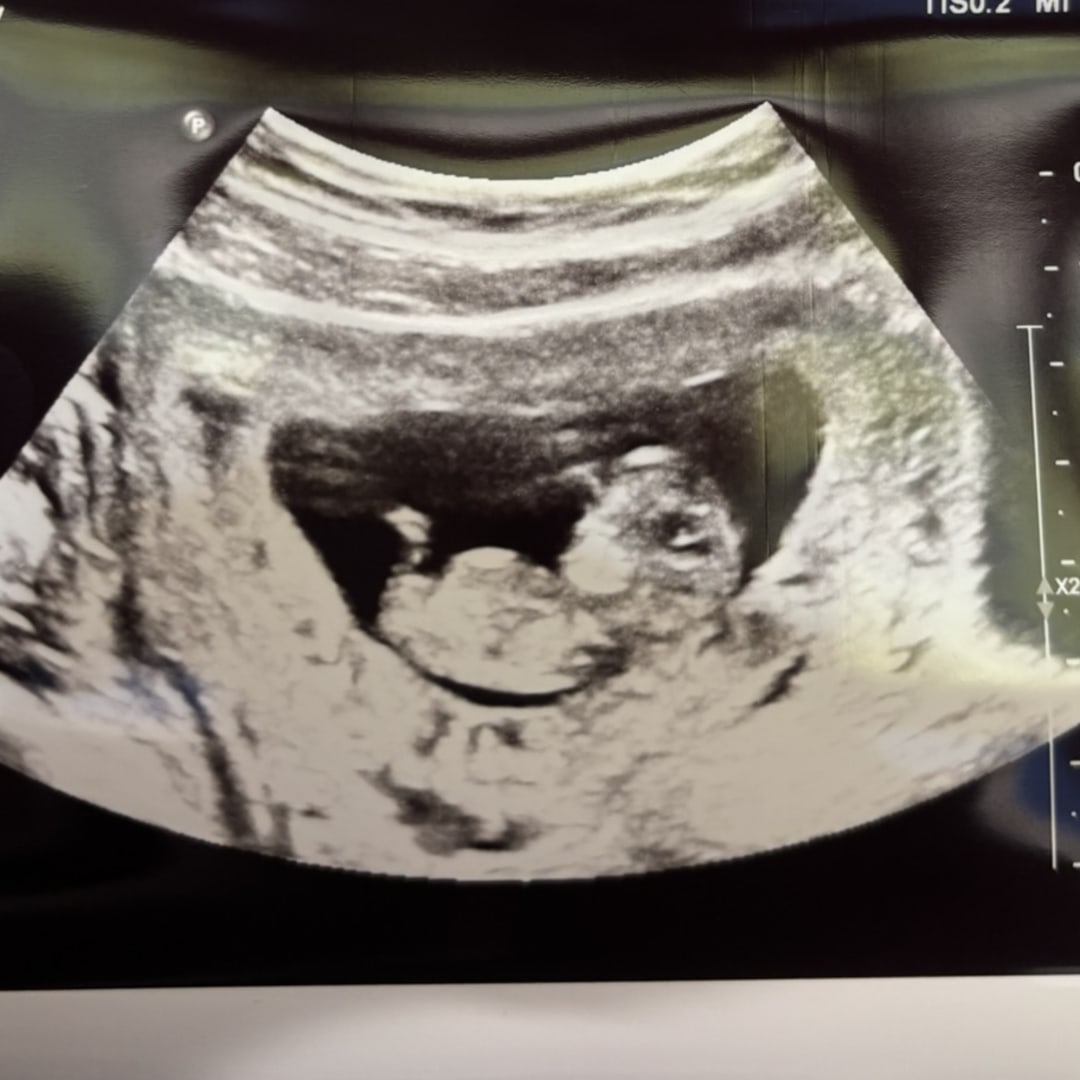 Photo shared by Cyrena-Isabel for their Babylist baby registry.