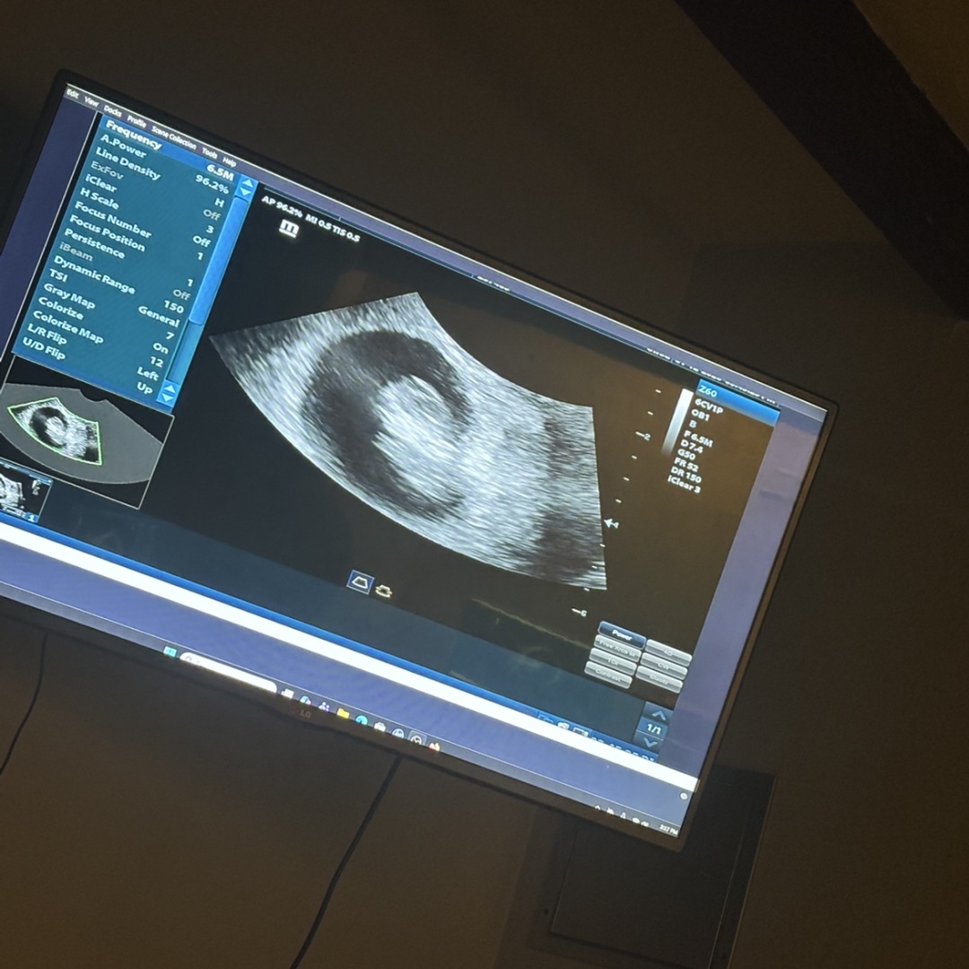 Photo shared by Samara for their Babylist baby registry.