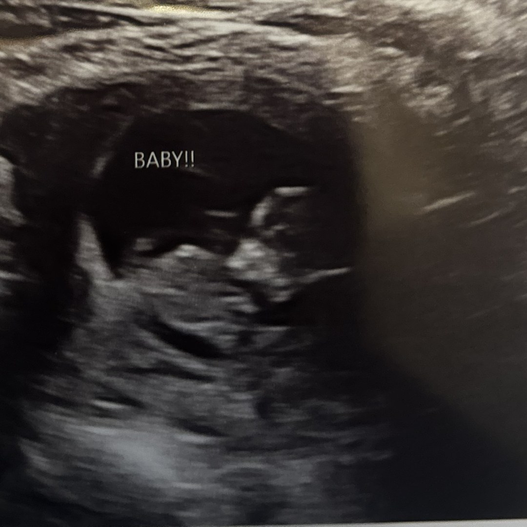 Photo shared by Vanessa for their Babylist baby registry.