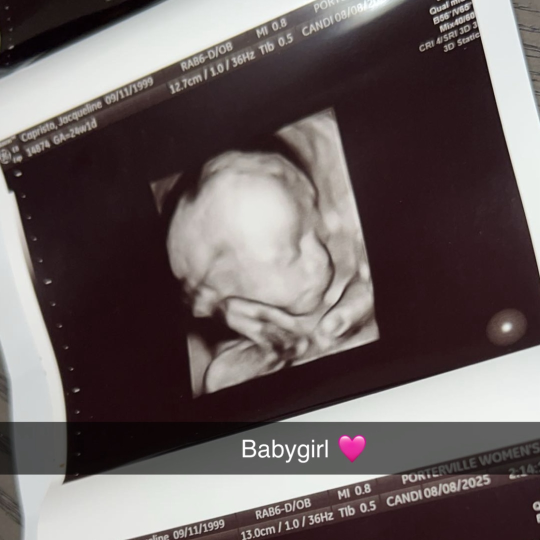 Photo shared by Jacqueline for their Babylist baby registry.