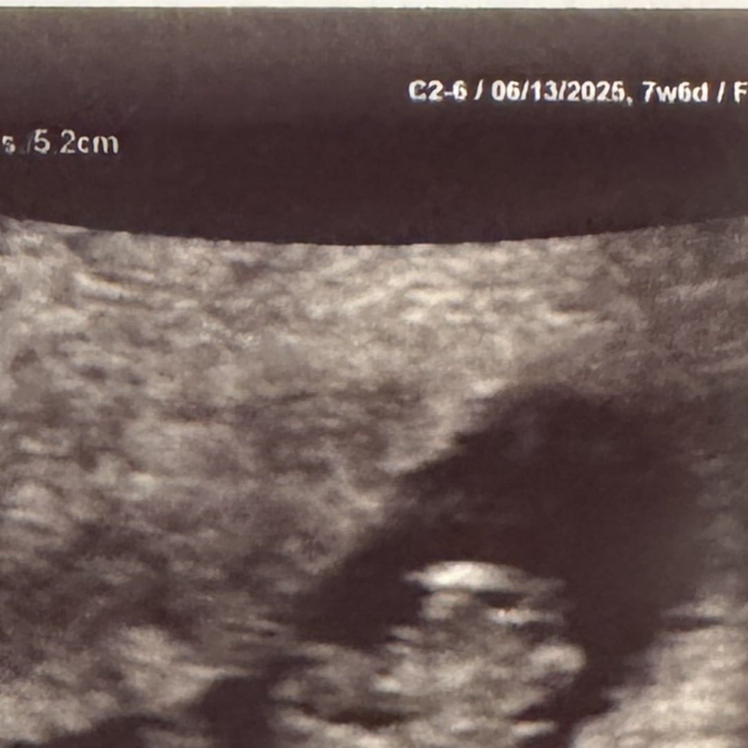Photo shared by Morgan for their Babylist baby registry.