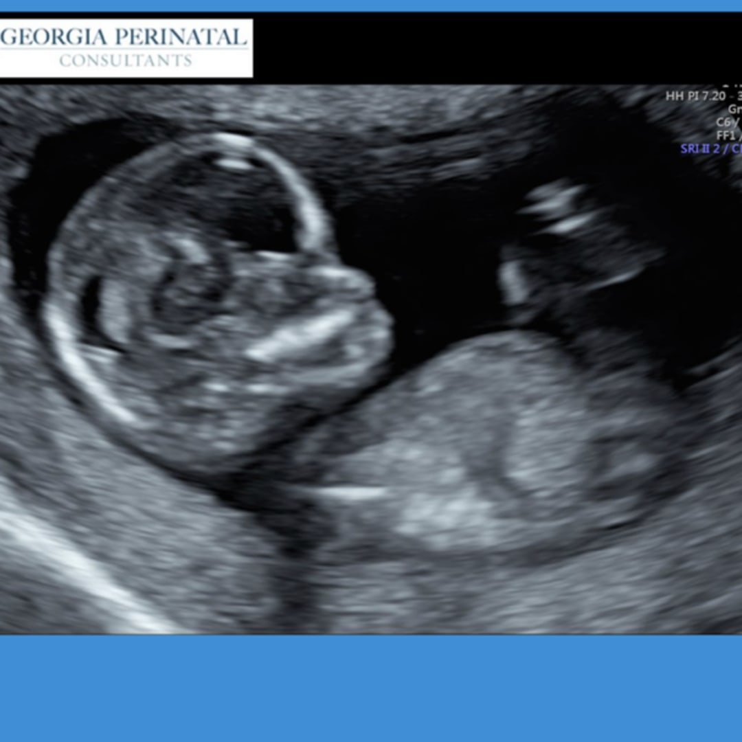 Photo shared by Toniah for their Babylist baby registry.
