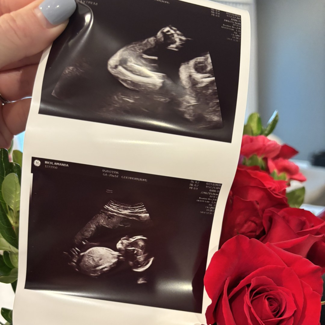 Photo shared by Amanda for their Babylist baby registry.