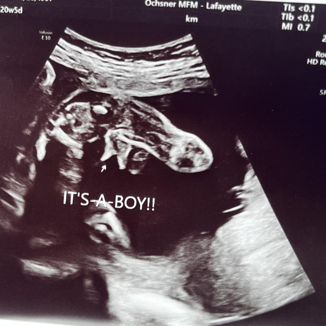 Photo shared by Josie for their Babylist baby registry.