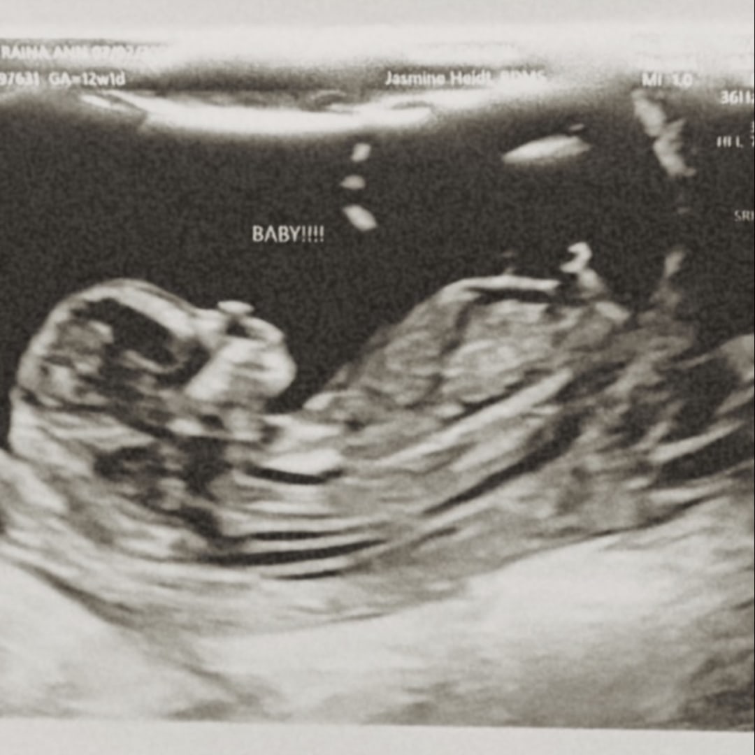 Photo shared by Raina for their Babylist baby registry.