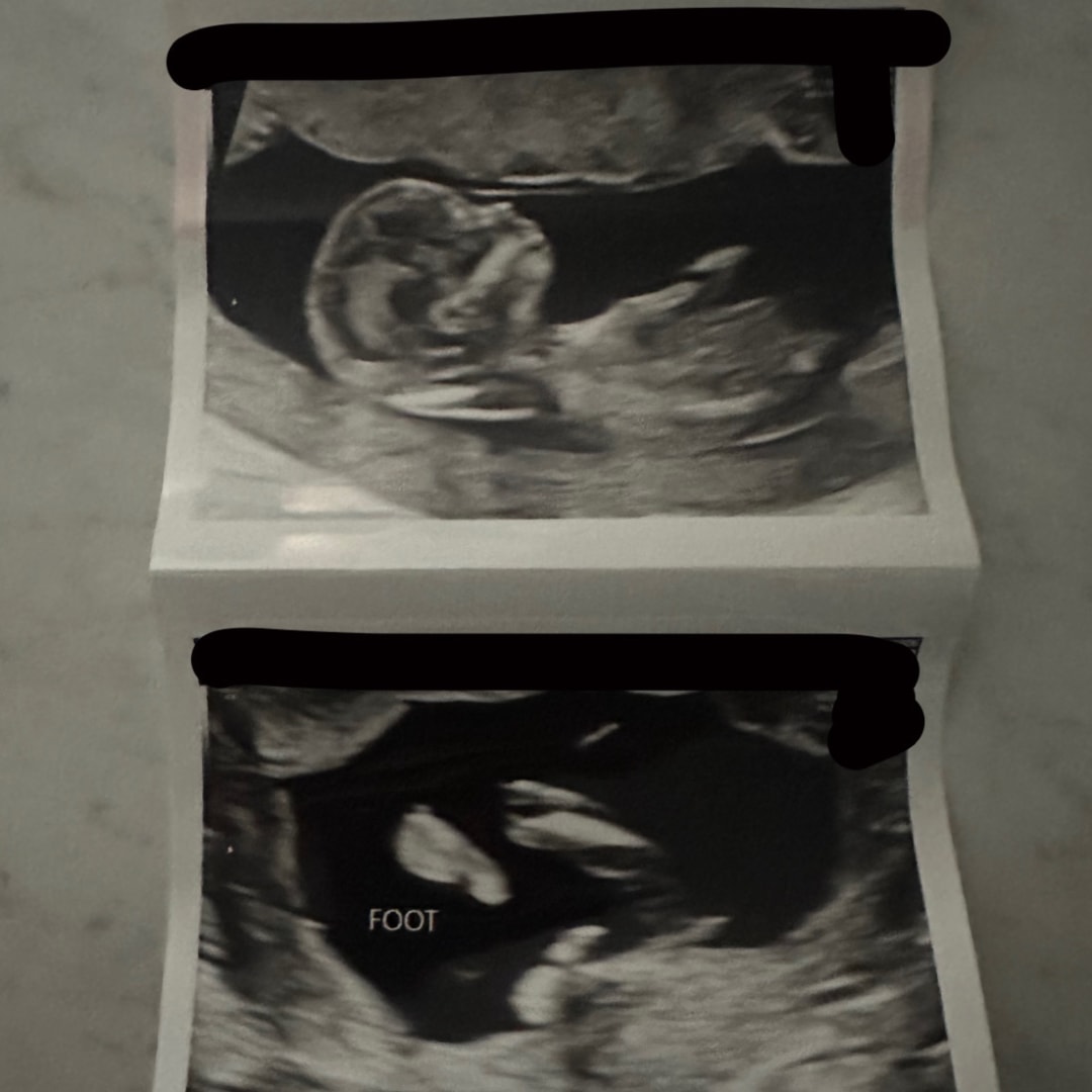 Photo shared by Haley for their Babylist baby registry.