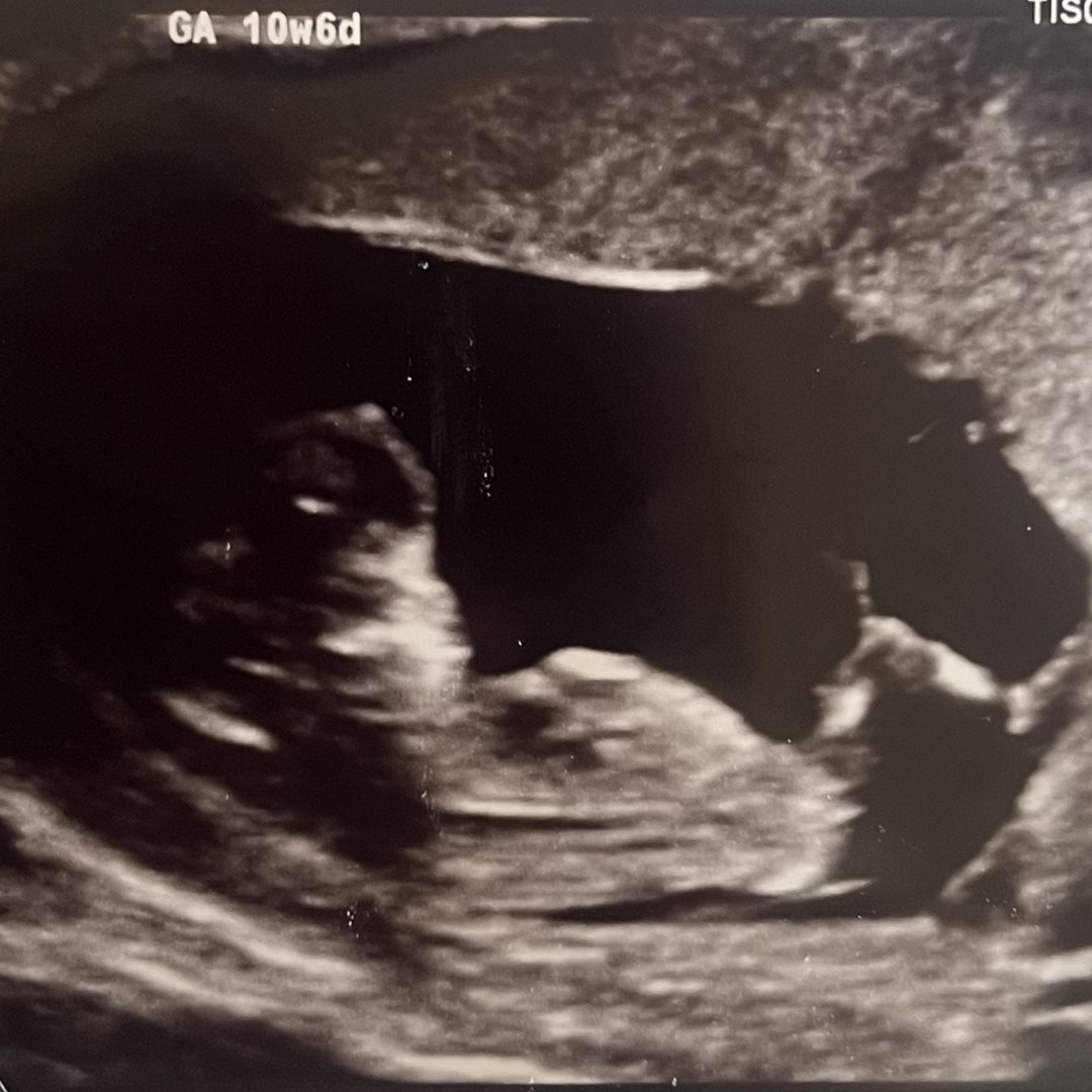 Photo shared by Keara for their Babylist baby registry.