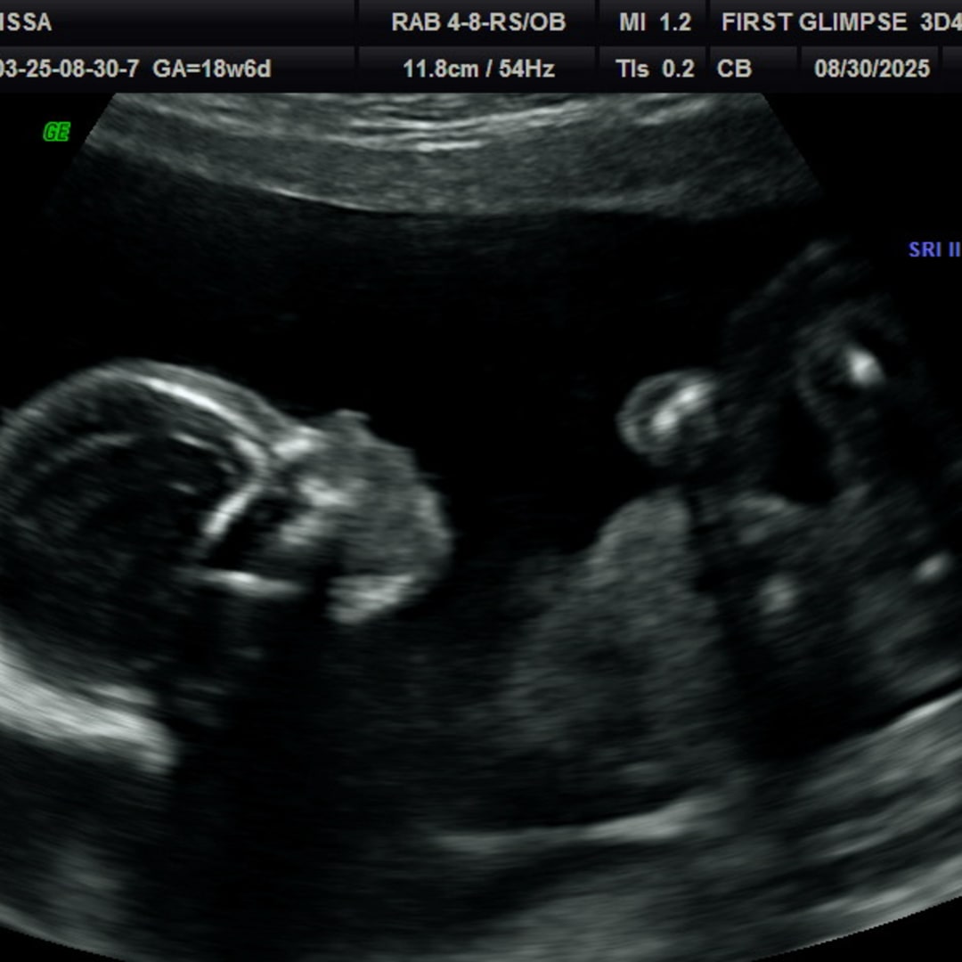 Photo shared by Gelissa for their Babylist baby registry.