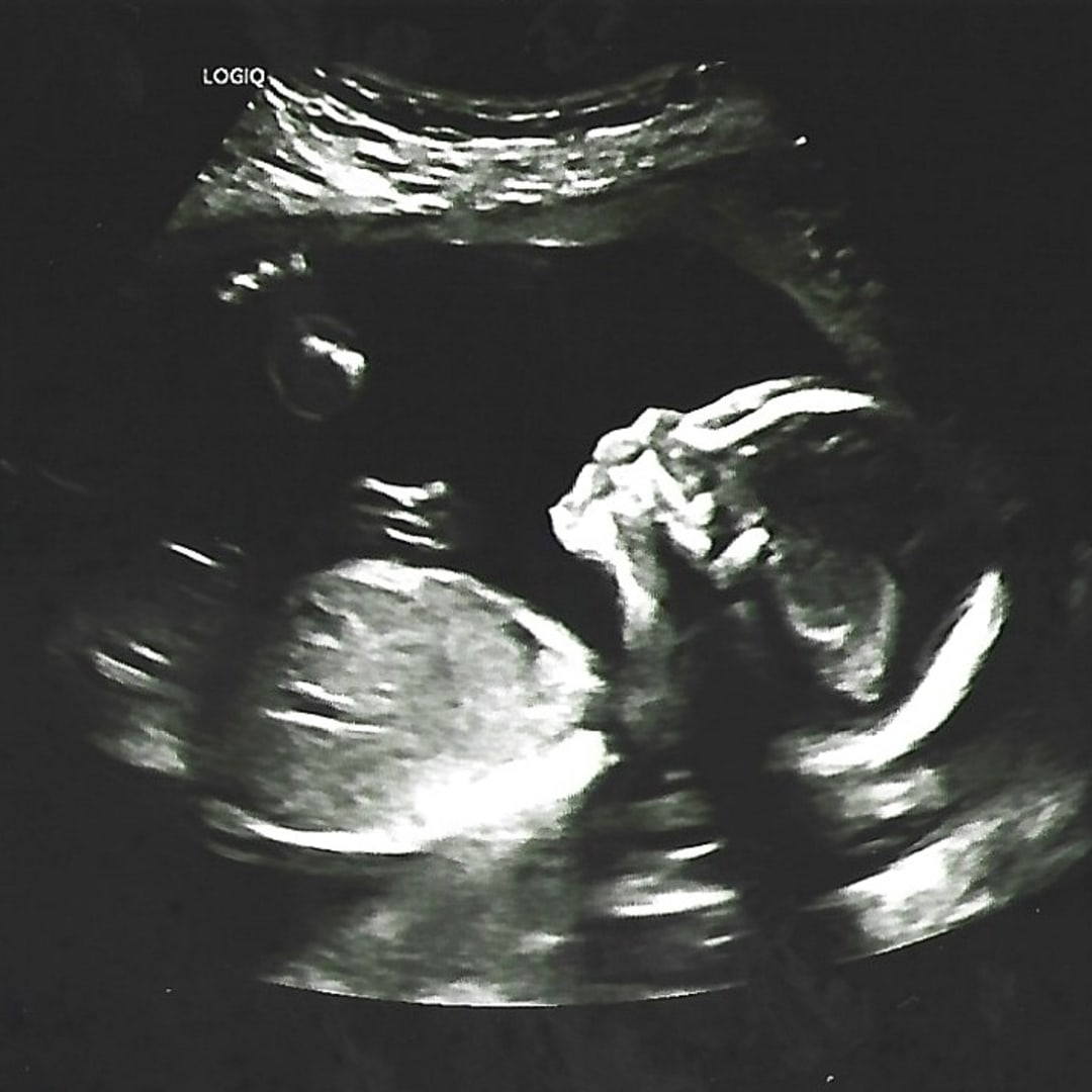 Photo shared by Heidi for their Babylist baby registry.