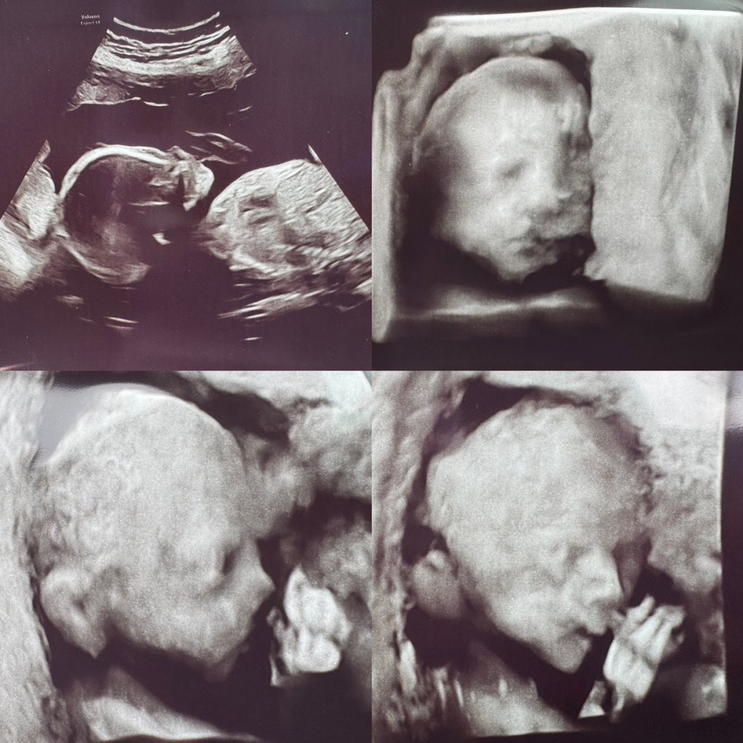 Photo shared by Hailey for their Babylist baby registry.